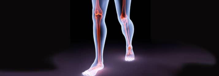 Joint-Pain Medical Spa Bentonville AR Joint Pain